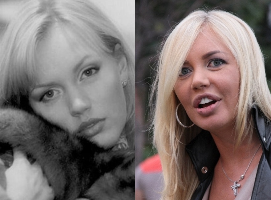 Радиус фото до и после