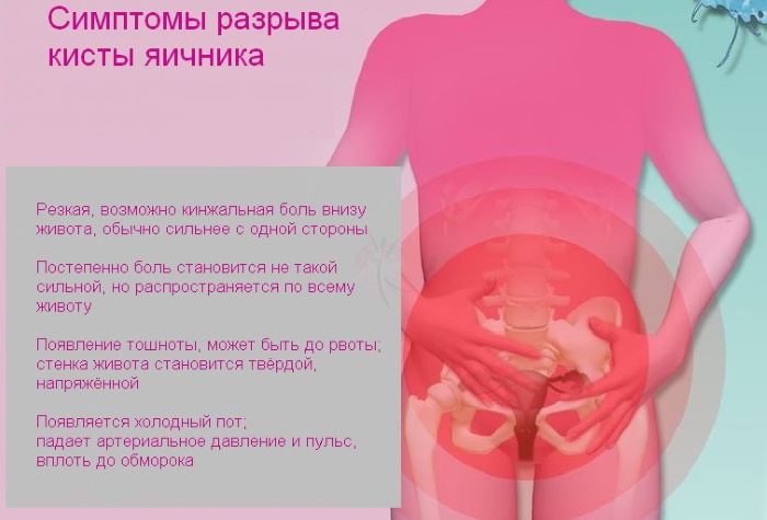 Яичники у женщин. Где находятся, размеры, симптомы воспаления, кисты, опухоли. УЗИ, лечение и последствия удаления