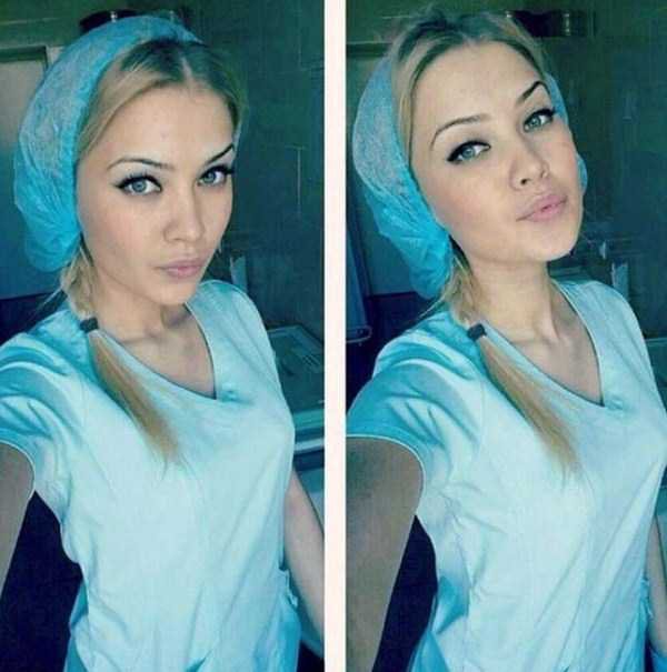Фото красивых девушек медсестер
